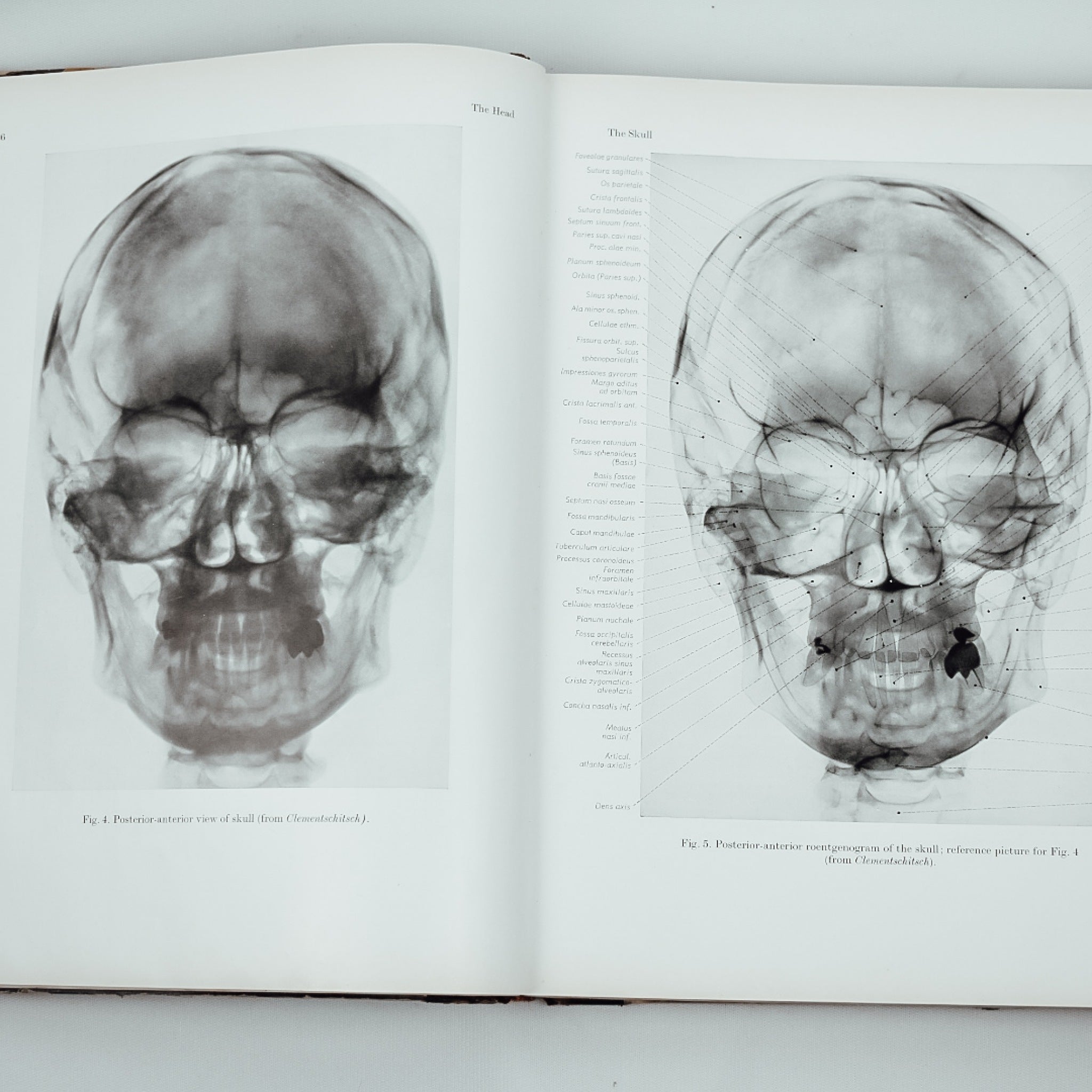 TOPOGRAPHICAL ATLAS OF HUMAN ANATOMY 4冊 Atlas of Topographical and Applied Human Anatomy, Vol. 1